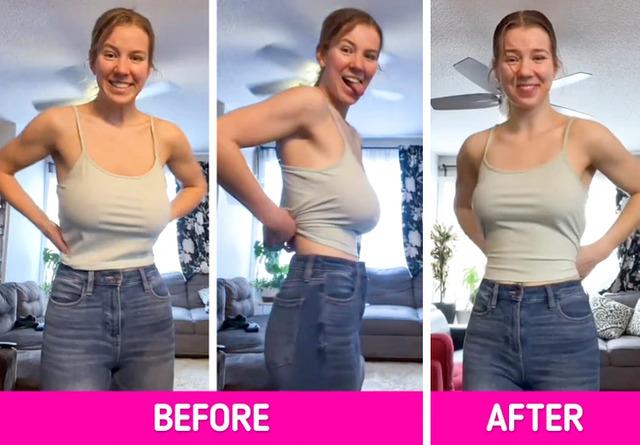 From Pain to Freedom: The Jaw-Dropping Transformation of Janel Nelson's Breast Reduction Journey