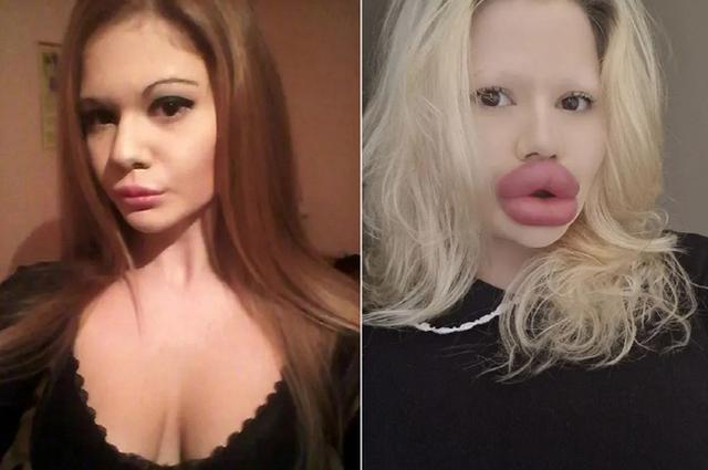 The Woman With the World’s Biggest Lips: Andrea Ivanova’s Unstoppable Journey of Transformation